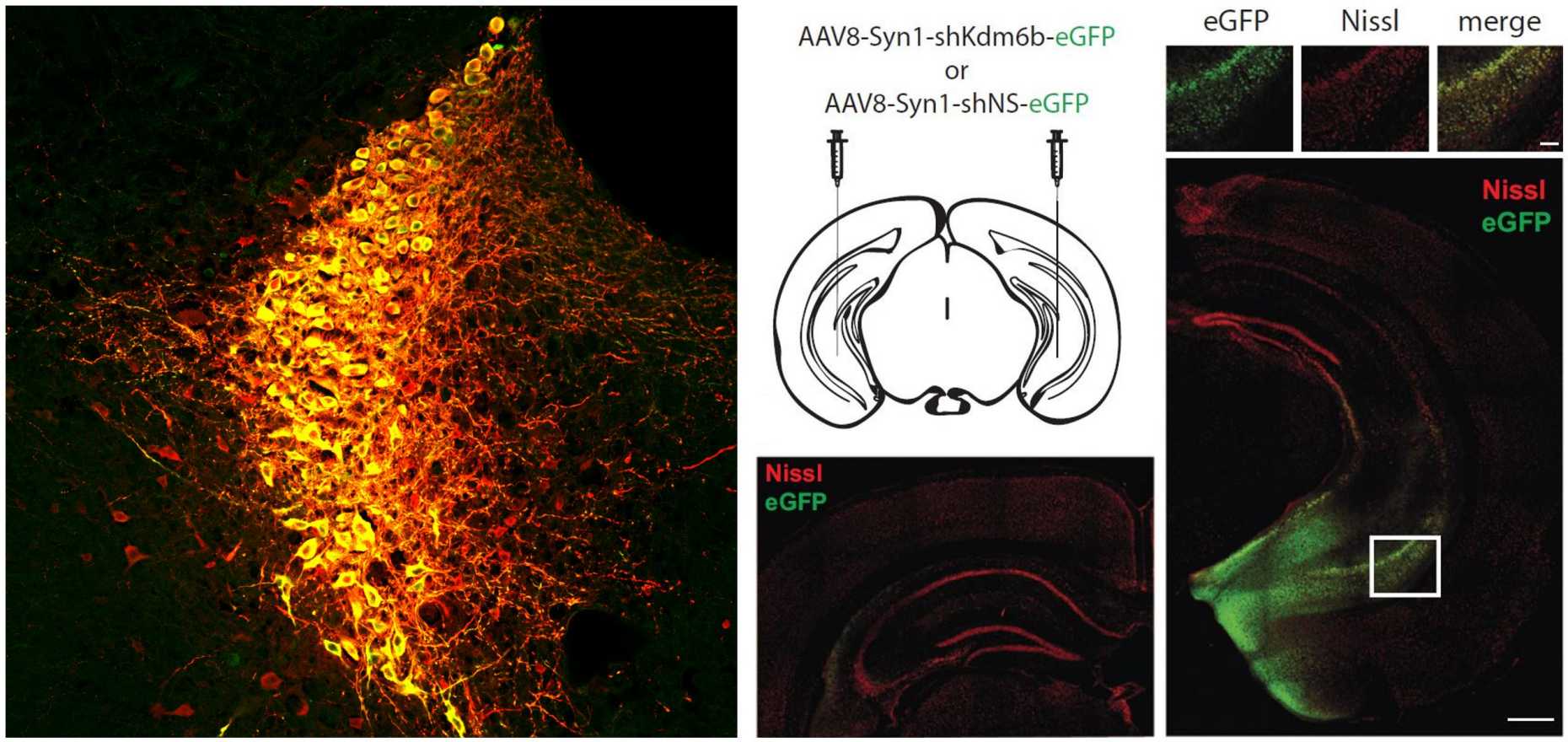stress amd brain: cell image